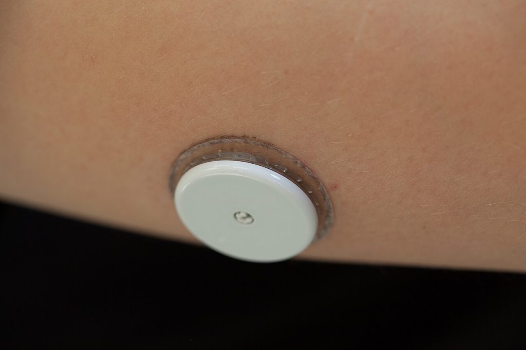 Glucose Monitors Give Type 2 Patients Five Hours Back FreeStyle Libre glucose sensor worn on the upper arm with reader